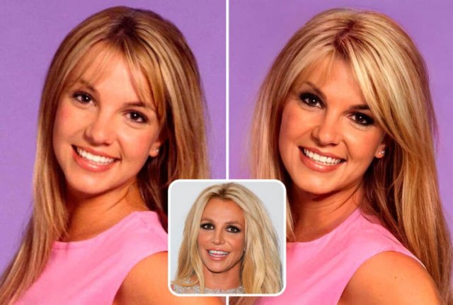 Famous People And Plastic Surgeries (21 pics) Famous People And Plastic Surgeries (21 pics)