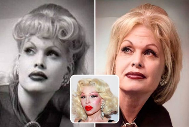 Famous People And Plastic Surgeries (21 pics) Famous People And Plastic Surgeries (21 pics)