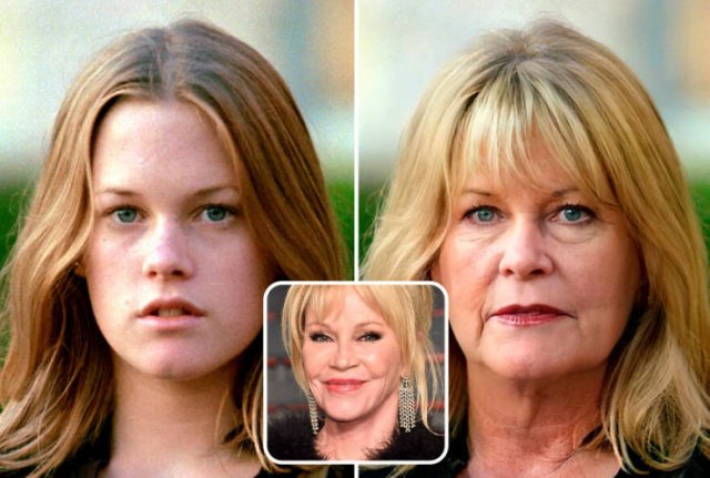 Famous People And Plastic Surgeries (21 pics) Famous People And Plastic Surgeries (21 pics)