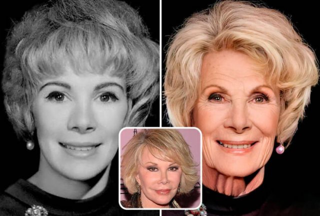 Famous People And Plastic Surgeries (21 pics) Famous People And Plastic Surgeries (21 pics)
