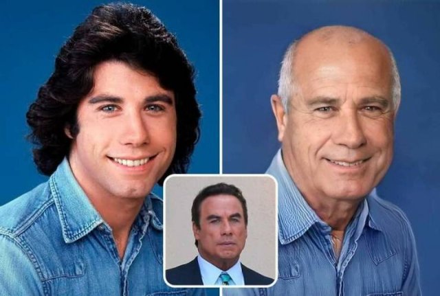 Famous People And Plastic Surgeries (21 pics) Famous People And Plastic Surgeries (21 pics)