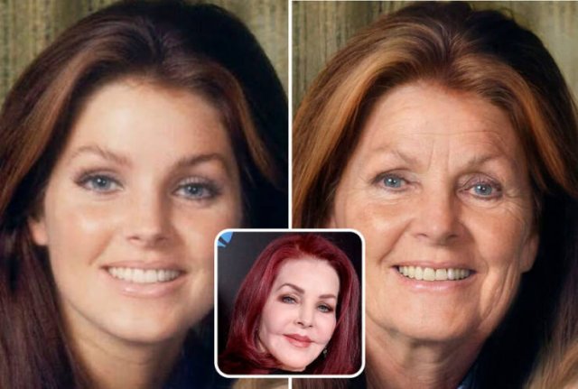 Famous People And Plastic Surgeries (21 pics) Famous People And Plastic Surgeries (21 pics)
