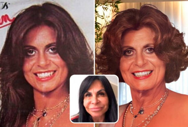 Famous People And Plastic Surgeries (21 pics) Famous People And Plastic Surgeries (21 pics)