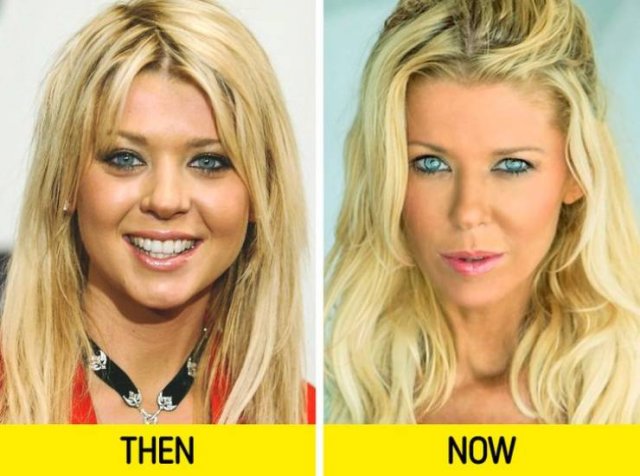 Celebrities Then And Now (10 pics)