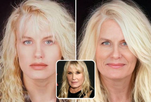 Famous People And Plastic Surgeries (21 pics) Famous People And Plastic Surgeries (21 pics)