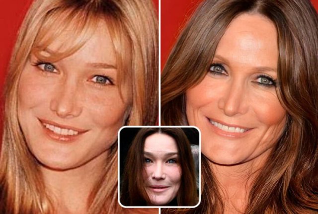 Famous People And Plastic Surgeries (21 pics) Famous People And Plastic Surgeries (21 pics)