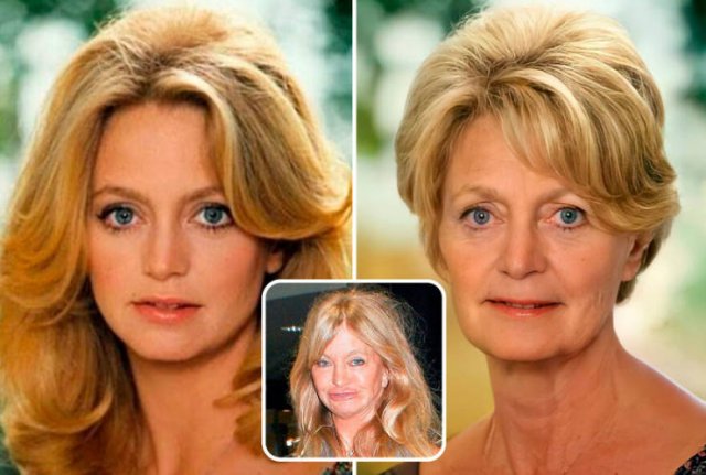 Famous People And Plastic Surgeries (21 pics) Famous People And Plastic Surgeries (21 pics)