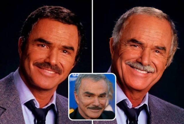 Famous People And Plastic Surgeries (21 pics) Famous People And Plastic Surgeries (21 pics)