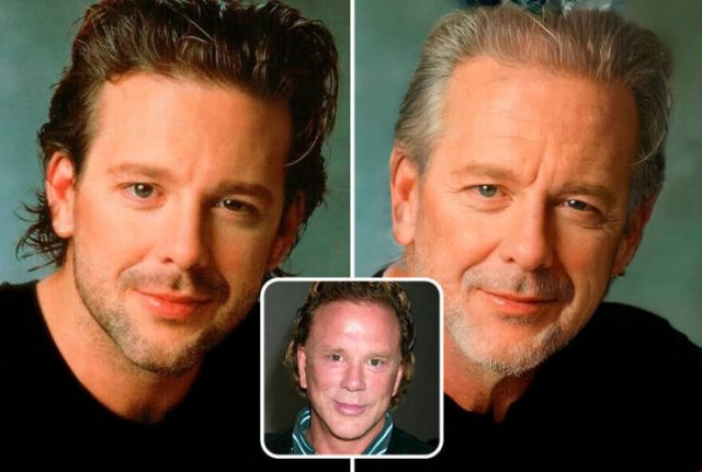 Famous People And Plastic Surgeries (21 pics) Famous People And Plastic Surgeries (21 pics)
