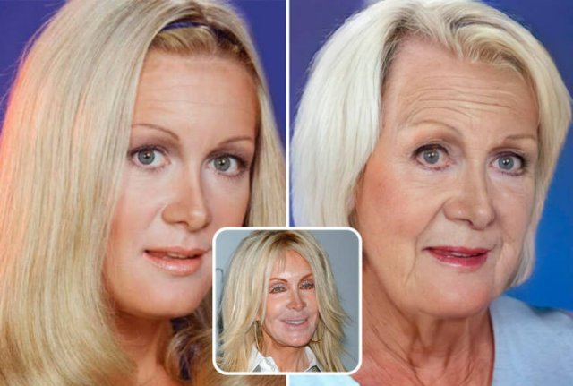 Famous People And Plastic Surgeries (21 pics) Famous People And Plastic Surgeries (21 pics)