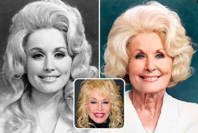 Famous People And Plastic Surgeries (21 pics) Famous People And Plastic Surgeries (21 pics)
