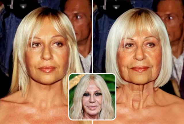Famous People And Plastic Surgeries (21 pics) Famous People And Plastic Surgeries (21 pics)
