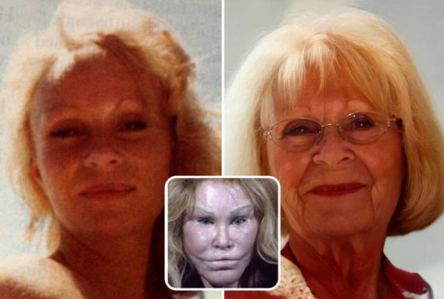 Famous People And Plastic Surgeries (21 pics) Famous People And Plastic Surgeries (21 pics)