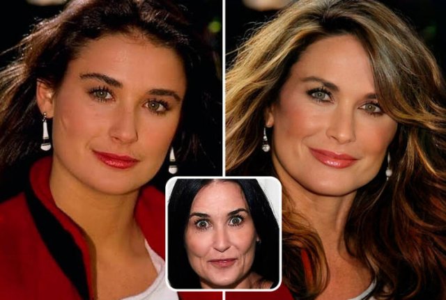 Famous People And Plastic Surgeries (21 pics) Famous People And Plastic Surgeries (21 pics)