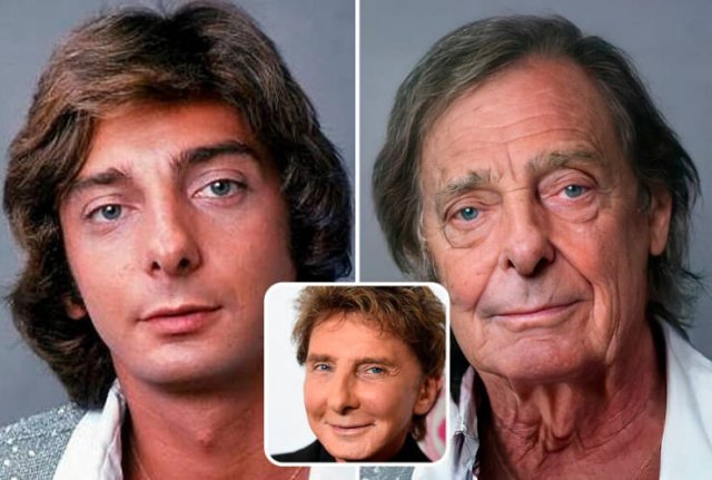 Famous People And Plastic Surgeries (21 pics) Famous People And Plastic Surgeries (21 pics)