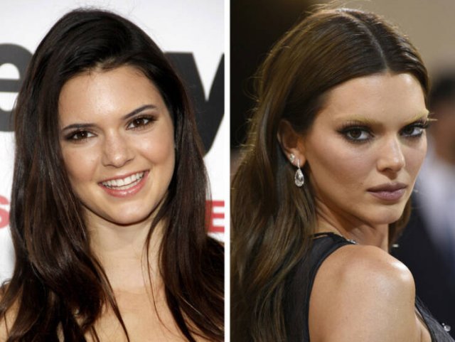 Celebrities Who Radically Changed Their Appearance (15 pics)