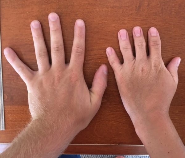 People With Unusual Body Features (13 pics) People With Unusual Body Features (13 pics)