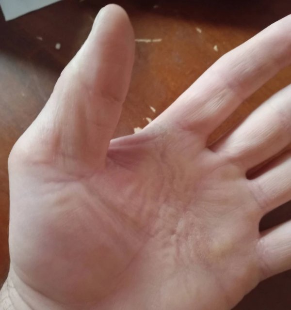 People With Unusual Body Features (13 pics) People With Unusual Body Features (13 pics)