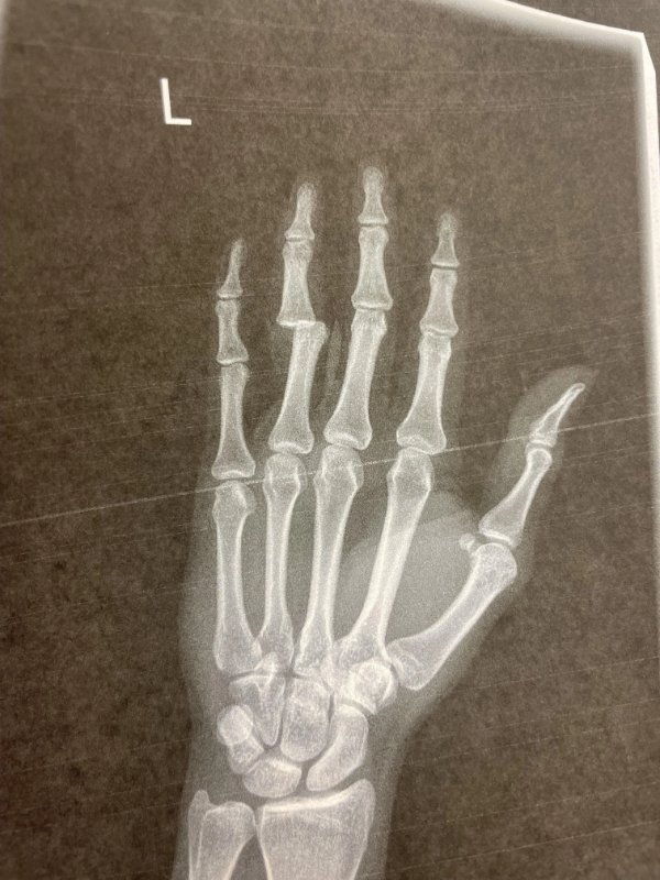 Bad Days Happen (17 pics)
