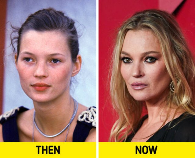 Celebrities Then And Now (14 pics) Celebrities Then And Now (14 pics)