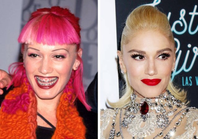 Celebrities Who Age Gracefully (16 pics) Celebrities Who Age Gracefully (16 pics)