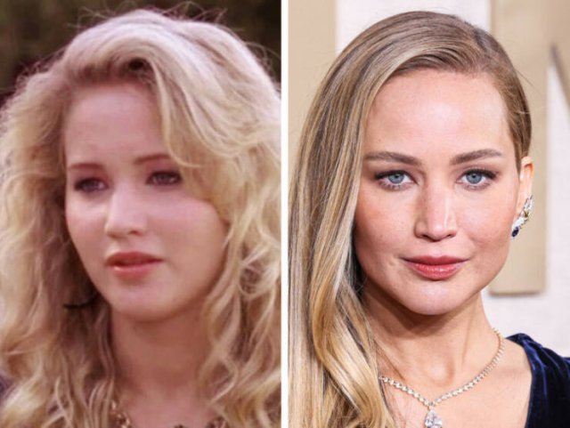 Famous Women Before And After Plastic Surgery (14 pics)