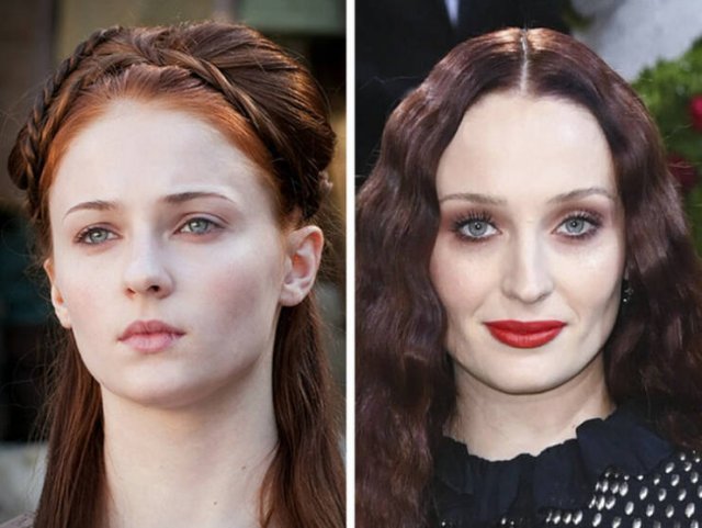 Famous Women Before And After Plastic Surgery (14 pics)