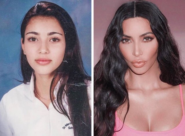 Famous Women Before And After Plastic Surgery (12 pics) Famous Women Before And After Plastic Surgery (12 pics)
