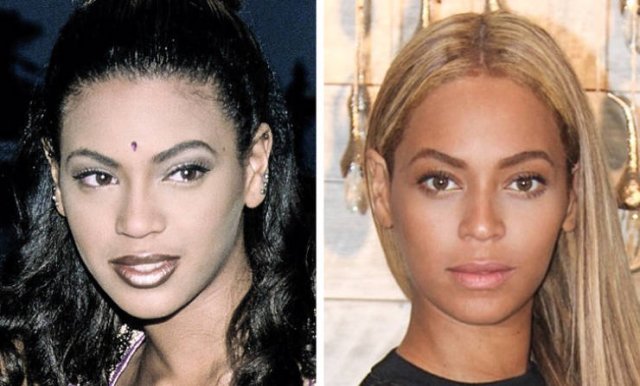 Famous Women Before And After Plastic Surgery (12 pics) Famous Women Before And After Plastic Surgery (12 pics)