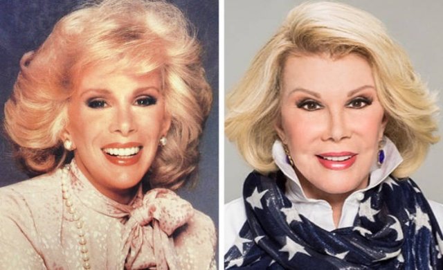 Famous Women Before And After Plastic Surgery (12 pics) Famous Women Before And After Plastic Surgery (12 pics)