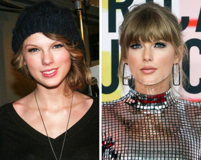Famous Women Before And After Plastic Surgery (12 pics) Famous Women Before And After Plastic Surgery (12 pics)