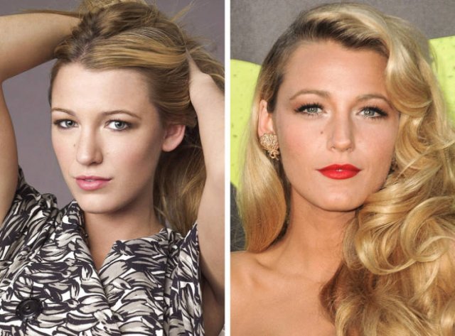 Famous Women Before And After Plastic Surgery (12 pics) Famous Women Before And After Plastic Surgery (12 pics)