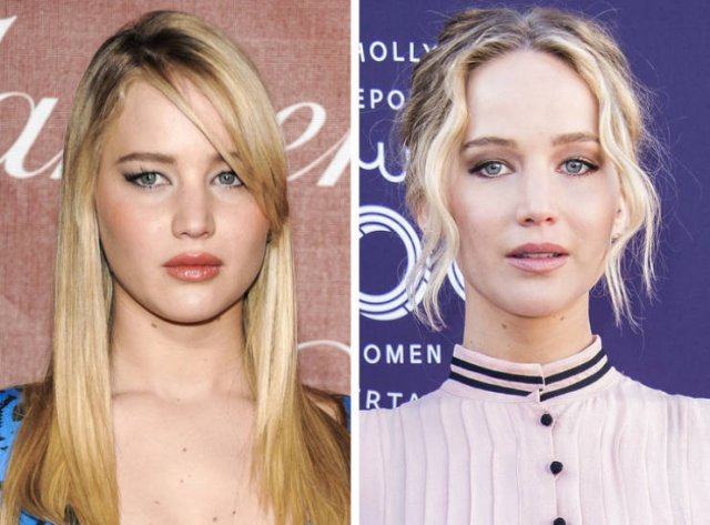 Famous Women Before And After Plastic Surgery (12 pics) Famous Women Before And After Plastic Surgery (12 pics)