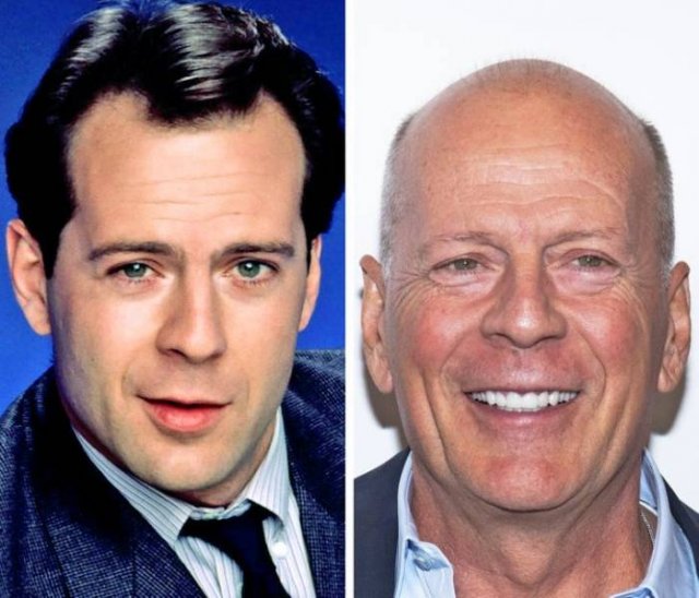Celebrities Then And Now (15 pics) Celebrities Then And Now (15 pics)