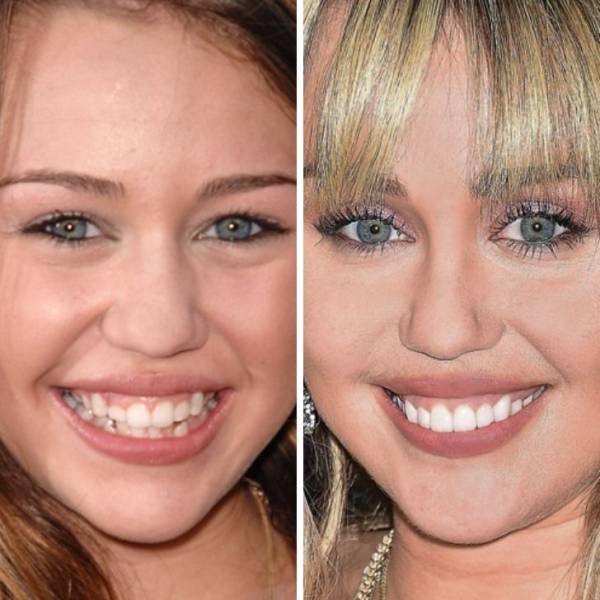 Celebrities Then And Now (24 pics) Celebrities Then And Now (24 pics)