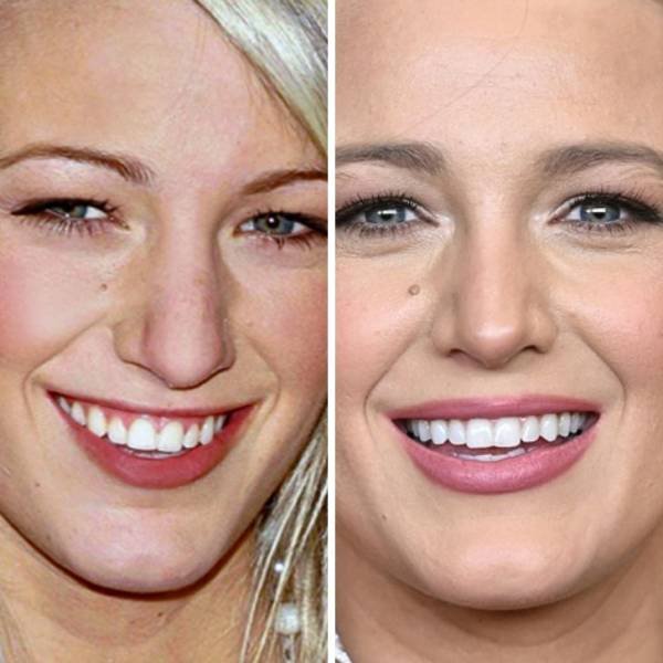 Celebrities Then And Now (24 pics) Celebrities Then And Now (24 pics)