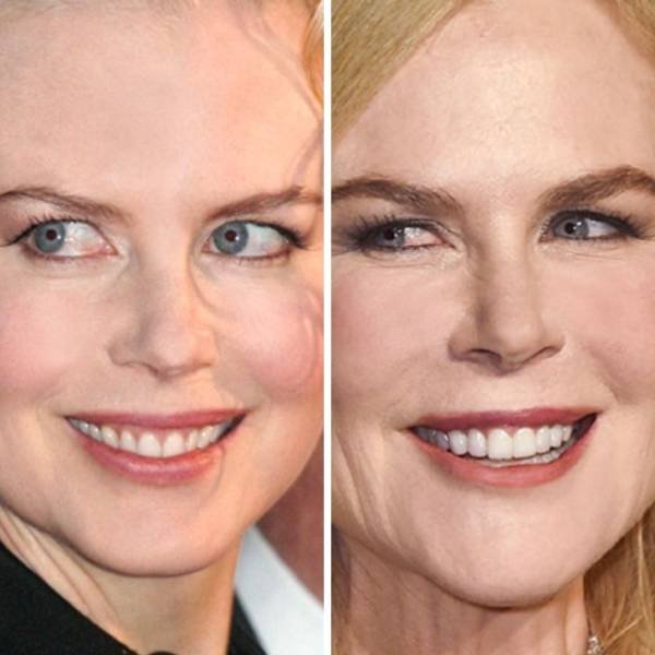 Celebrities Then And Now (24 pics) Celebrities Then And Now (24 pics)