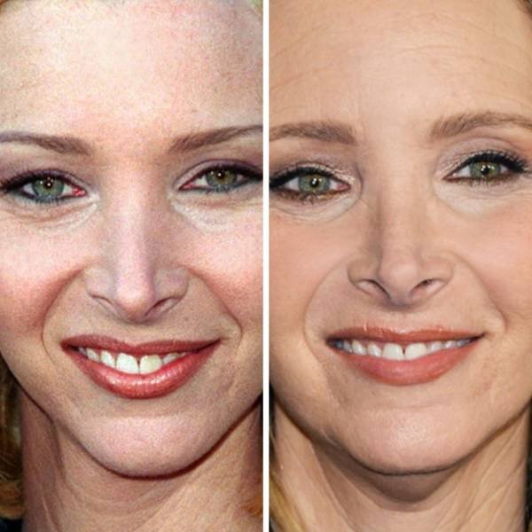 Celebrities Then And Now (24 pics) Celebrities Then And Now (24 pics)