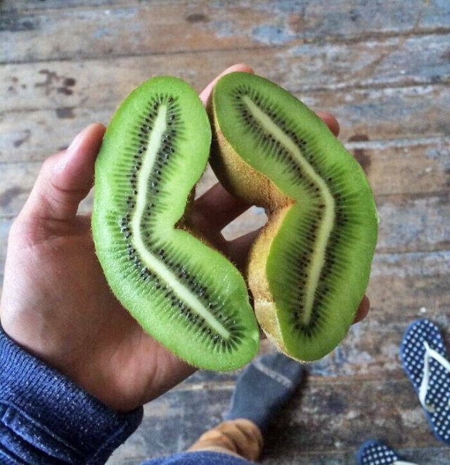 People Who Won The Food Lottery (25 pics)
