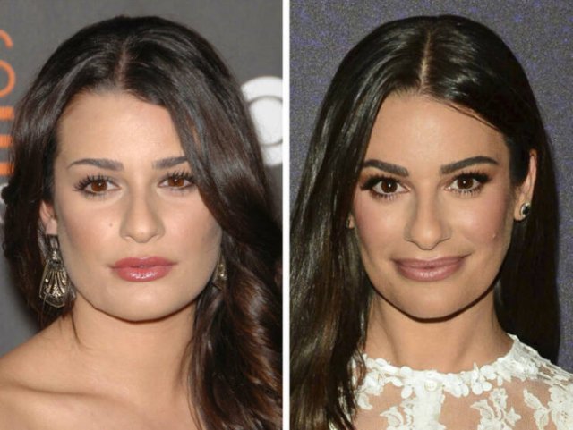 Famous Women Before And After Plastic Surgery (14 pics) Famous Women Before And After Plastic Surgery (14 pics)