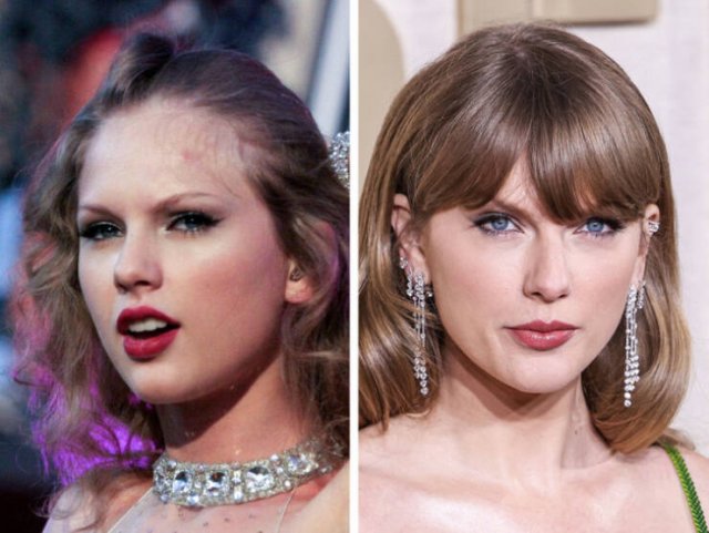 Famous Women Before And After Plastic Surgery (14 pics) Famous Women Before And After Plastic Surgery (14 pics)