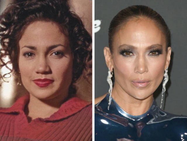 Famous Women Before And After Plastic Surgery (14 pics) Famous Women Before And After Plastic Surgery (14 pics)