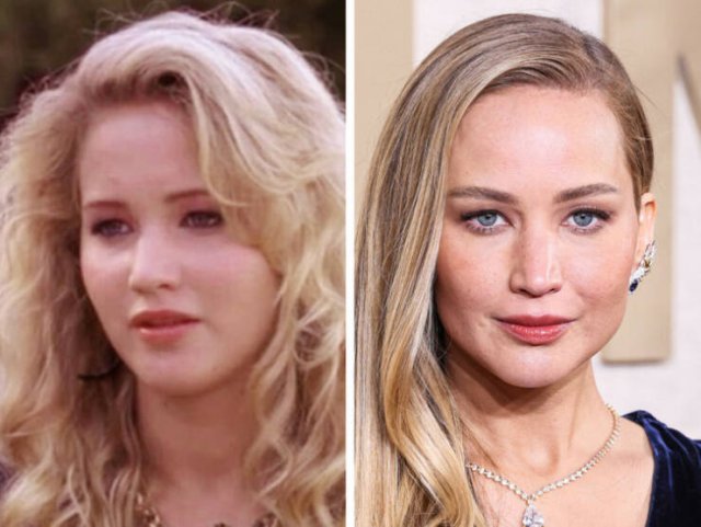 Famous Women Before And After Plastic Surgery (14 pics) Famous Women Before And After Plastic Surgery (14 pics)