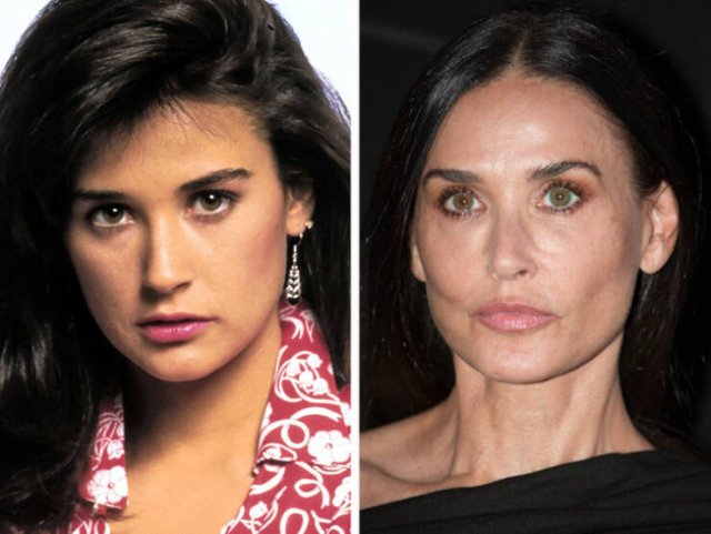 Famous Women Before And After Plastic Surgery (14 pics)
