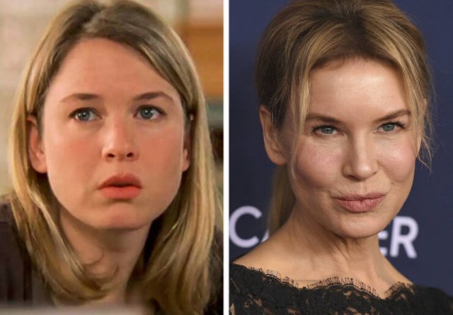 Famous Women Before And After Plastic Surgery (14 pics) Famous Women Before And After Plastic Surgery (14 pics)
