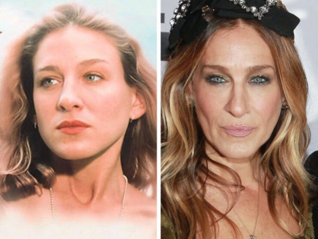 Famous Women Before And After Plastic Surgery (14 pics) Famous Women Before And After Plastic Surgery (14 pics)