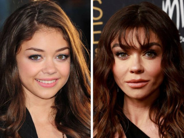 Famous Women Before And After Plastic Surgery (14 pics) Famous Women Before And After Plastic Surgery (14 pics)