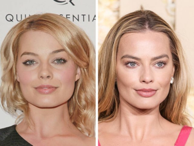 Famous Women Before And After Plastic Surgery (14 pics) Famous Women Before And After Plastic Surgery (14 pics)
