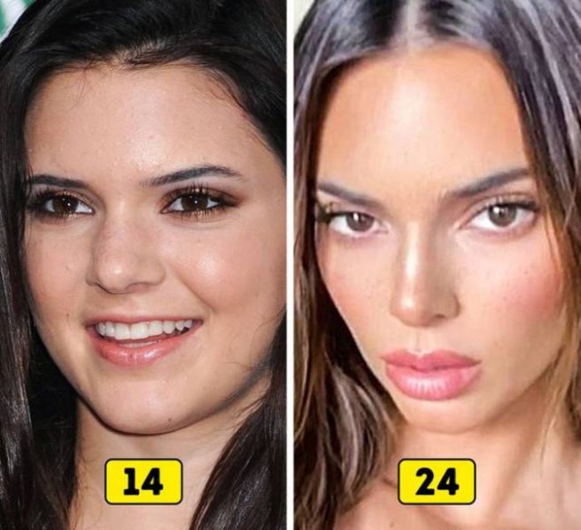 How Celebrities Changed In 10 Years (27 pics)