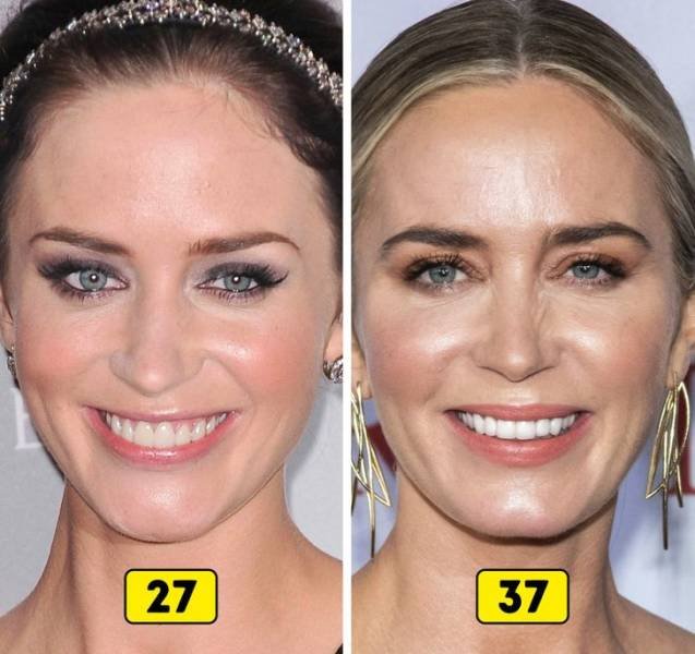 How Celebrities Changed In 10 Years (27 pics)